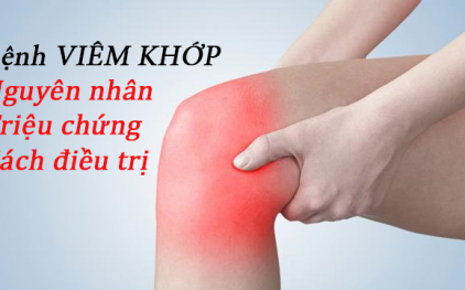 Đau nhức xương khớp: Khái niệm, nguyên nhân, triệu chứng và cách điều trị